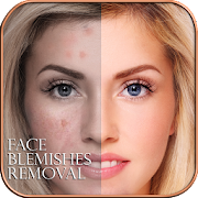 Face Blemishes Removal