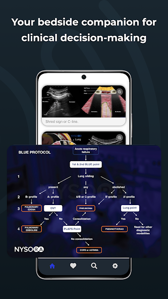 Point of Care Ultrasound